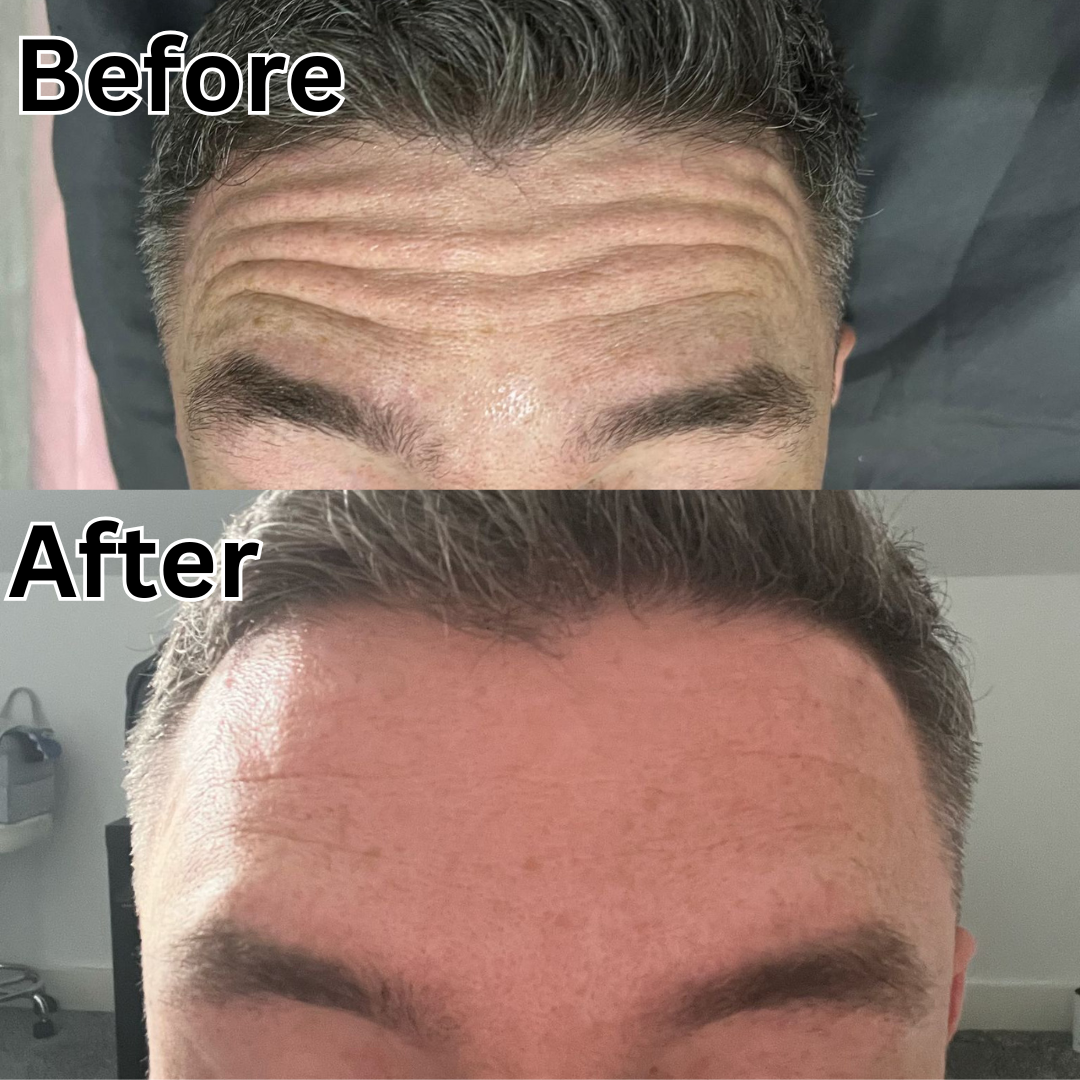 microblading before and after, microblading by la, semi permanent make up artist in dunstable, milton keynes, luton, bedford, leighton buzzard, hemel hempstead, near me 