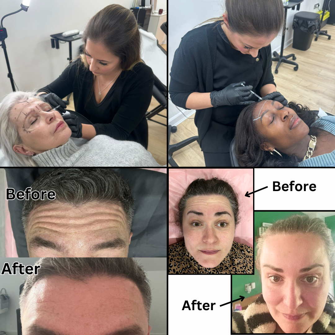 ANTI WRINKLE INJECTIONS BOTOX NEAR ME DUNSTABLE MILTON KEYNES BEDFORDSHIRE LUTON HOUGHTON REGIS CADDINGTON EATON BRAY TODDINGTON HARPENDEN ST ALBANS BERKHAMSTEAD ANTI WRINKLE INJECTIONS BOTOX NEAR ME DUNSTABLE MILTON KEYNES BEDFORDSHIRE LUTON HOUGHTON REGIS CADDINGTON EATON BRAY TODDINGTON HARPENDEN ST ALBANS BERKHAMSTEAD